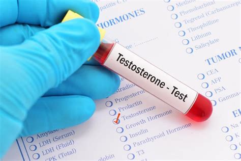 As with any blood test, it is important that the kit you purchase is clean of any residual blood and is properly labeled. . How to cheat a testosterone blood test